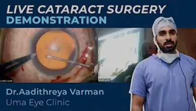 Live Cataract Surgery Demonstration | Dr. Aadithreya Varman | Uma Eye Clinic