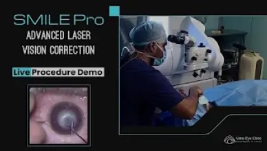 SMILE Pro Live procedure demonstration | Madras City Ophthalmic association meeting | Uma Eye Clinic