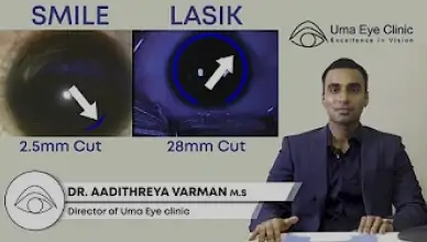 Smile and lasik laser vision correction explained by DR. AADITHREYA VARMAN MS | Uma eye clinic