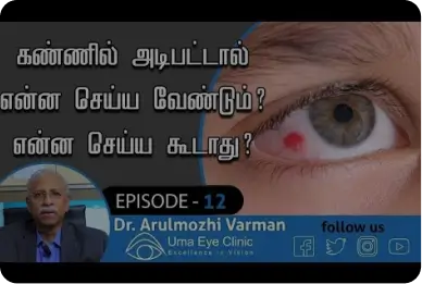 கண்ணில் அடிபட்டால் செய்ய வேண்டியவை செய்ய கூடாதவை? | First Aid During Eye Injury? | Uma Eye Clinic