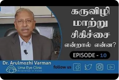 கருவிழி மாற்று சிகிச்சை | Corneal transplantation | Dr Arulmozhi Varman | Uma Eye Clinic | EPI 10