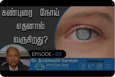 கண்புரை நோய் எதனால் வருகிறது? | what causes cataract? | Dr Arulmozhi Varman, Uma Eye Clinic, EPI 03