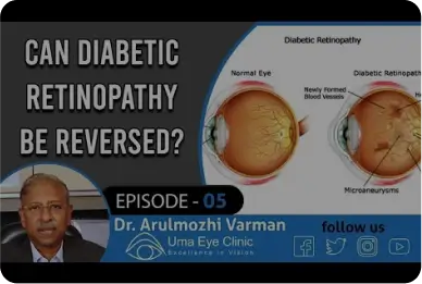 Diabetes Retinopathy | Can Diabetic Retinopathy Be Reversed? | Dr Arulmozhi Varman | EPI 05