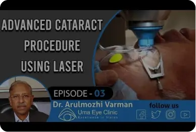 Advanced cataract procedure using laser catalys | Uma Eye Clinic, Anna Nagar | EPI 03