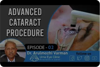 Cataract Surgery | Advanced cataract procedure video | Dr. Arulmozhi Varman | EPI 02